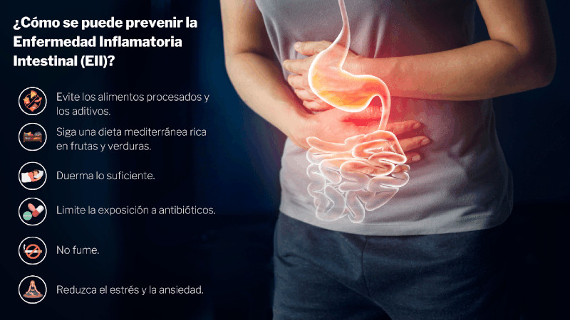 ¿Se puede prevenir la enfermedad inflamatoria intestinal?