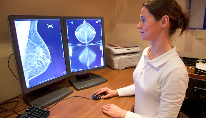 15 segundos que pueden salvarte la vida: por qué perder el miedo a la mamografía