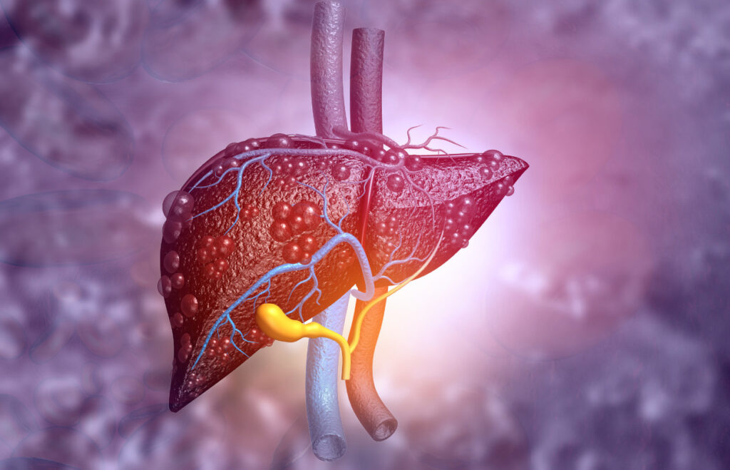 Hepatitis C, una infección que puede curarse en más del 95% de los casos
